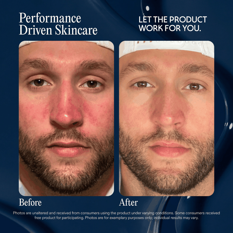 Looping before and after photos from six customers who used Revival, showing calmer, more even skin.